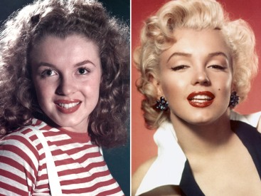 marilyn-monroe-chin-implant-before-after